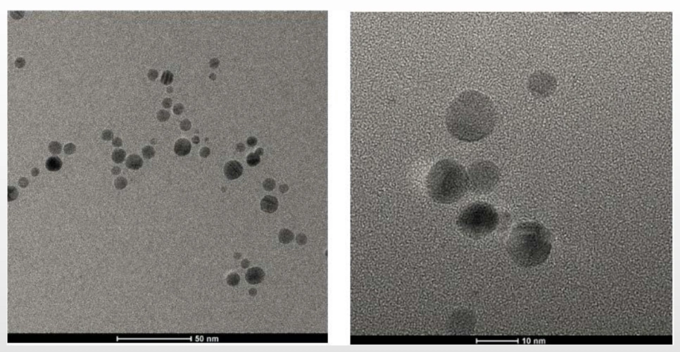 纳米银离子电镜图