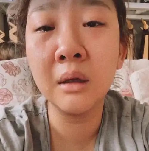 眼睛红肿毫无形象