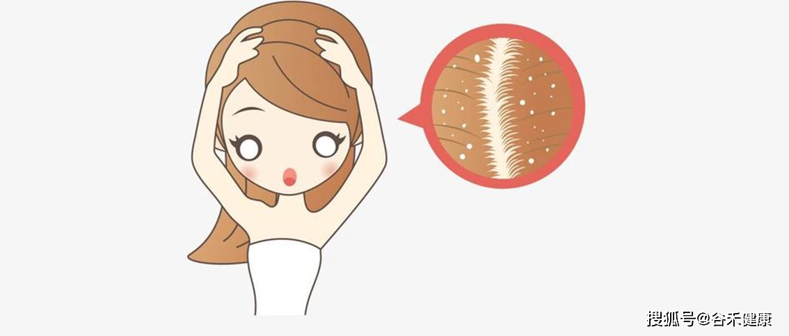 头皮屑与菌群有关科学的去屑建议