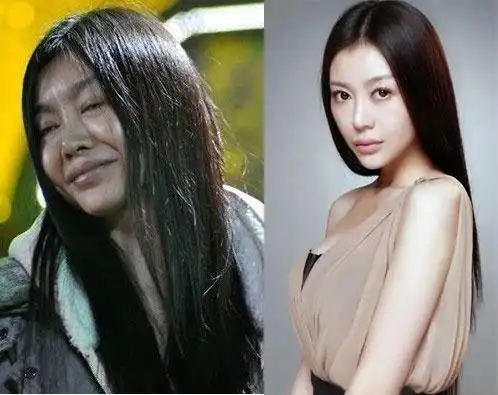 巩新亮僵脸尖下巴亮相惹争议 被疑再次整容