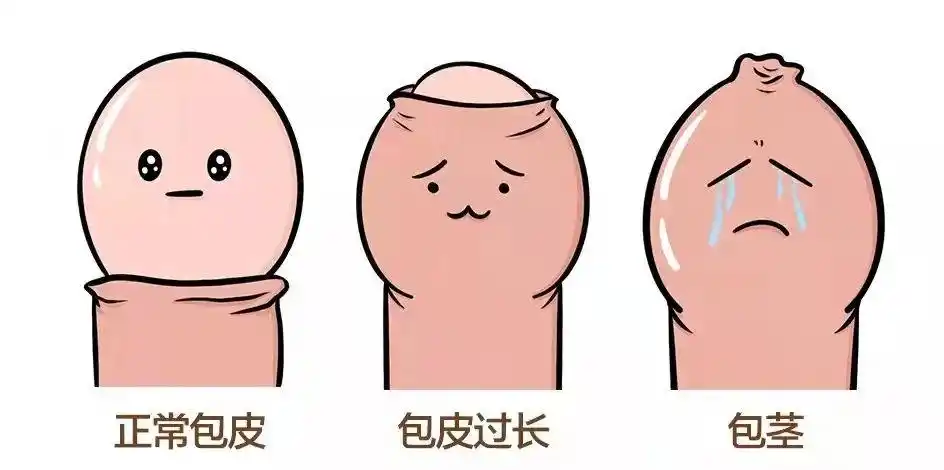 男友丁丁出现这几种情况,一定要让他速割包皮!