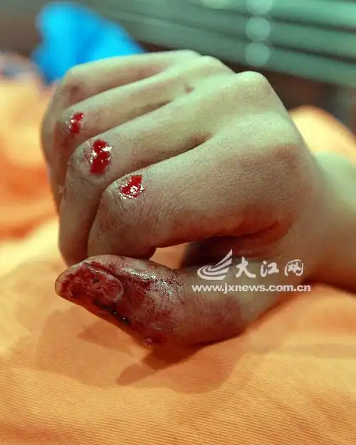 正义的手上染满鲜血.