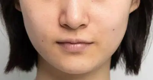 而贾玲是唇形整体比较薄,而且下唇比上唇薄,上唇线比较清晰.