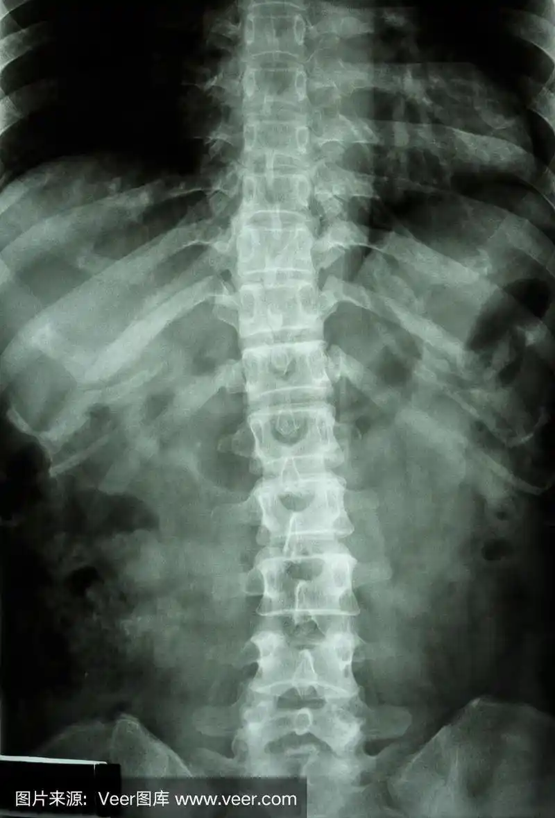 正常人的胸腰椎