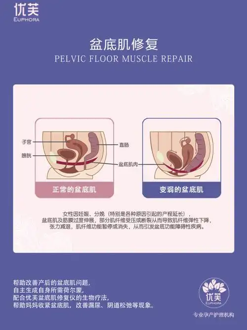 阴道壁膨出的原因是什么泰安产后