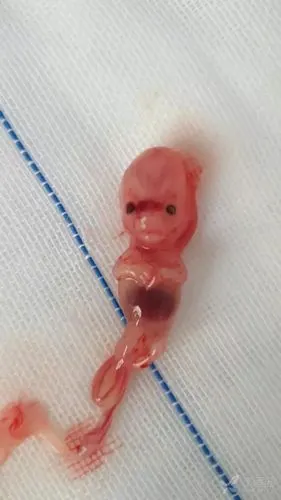 应各位同仁的要求,再次发出来了,60多天药物流产下来的,非常完整.