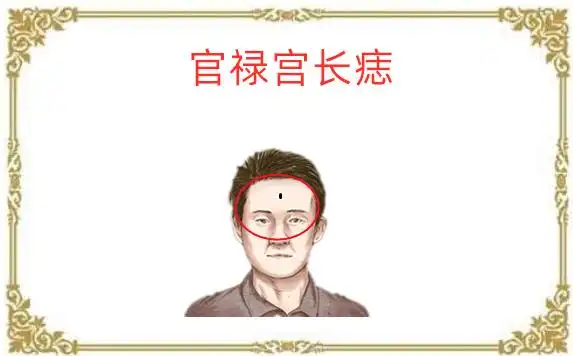 身体5颗"破财"痣,左手进财右手出,积蓄全无,打一辈子工!|左手|右手|田