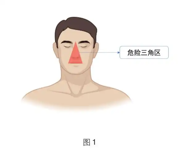 皮肤科医生提醒有颅内感染风险危险三角区的粉刺别乱挤