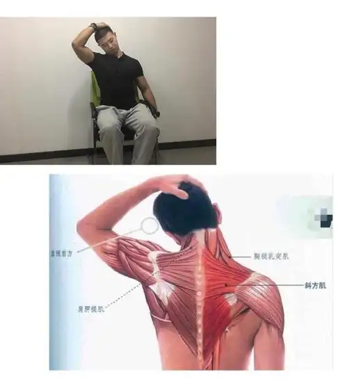 颈部不舒服?试试这几个拉伸方法