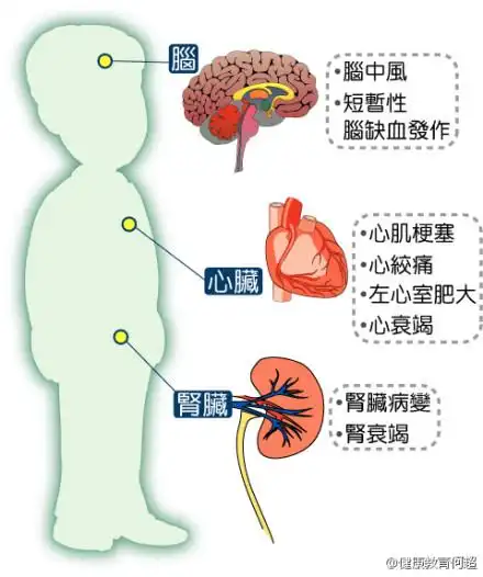 高血压并发症的介绍