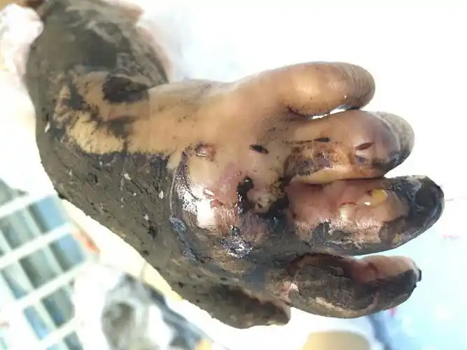 炎炎列日,谨防蛇咬伤!