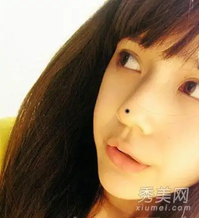 痣相分析:鼻子上长痣好不好?