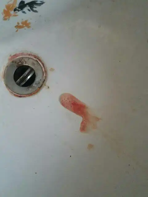 男生吐血怎么回事?男生抽烟偶尔喝酒,饮食不太规律.