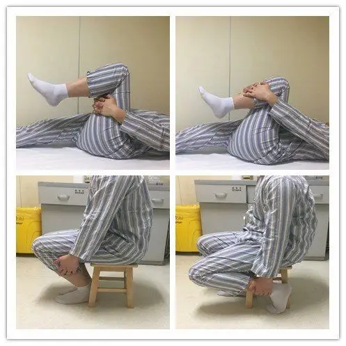 微创全膝关节表面成形术后康复锻炼指导