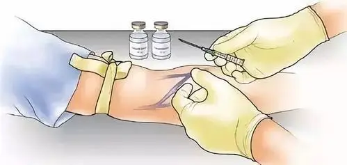 输液结束未及时拔针怎么处理?_静脉