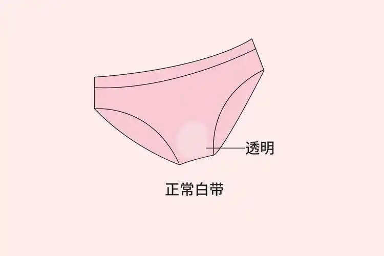 什么样的白带才算正常_39健康网_精编内容