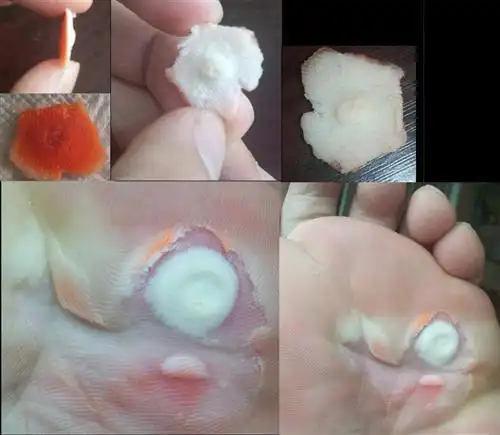 脚长鸡眼是什么原因?_39健康经验