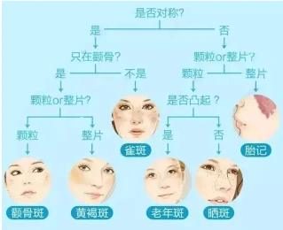 激光祛斑只要一次治疗就可以完成?【昆明华美美莱】