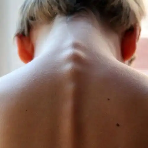 致敬首届中国医师节关爱少年儿童脊柱健康我们来了