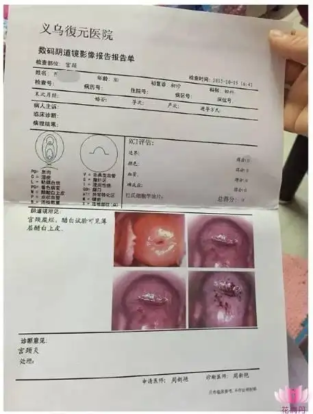 用隆力奇花清丹后伴随我多年的痛经,盆腔炎,宫颈炎就这么轻易消失了