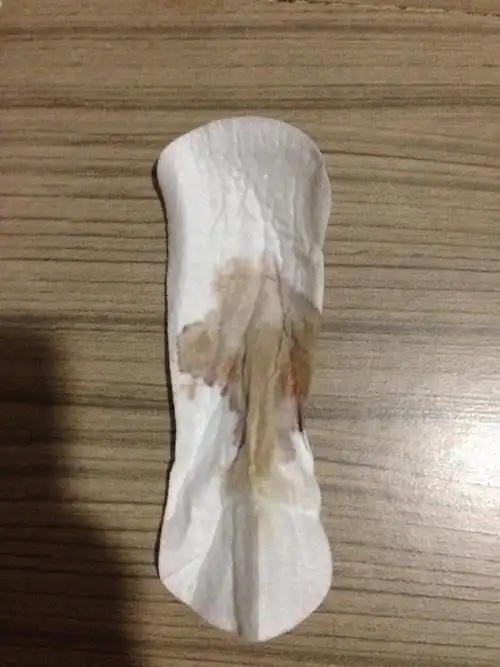 急刚上厕所发现护垫上有这些