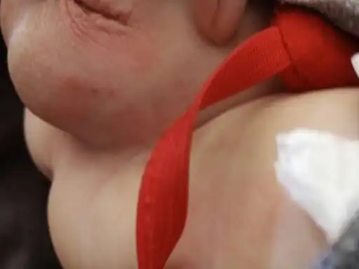 推荐回答 你好,首先不要长时间地给宝宝使用的纸尿裤,需要保持宝宝的