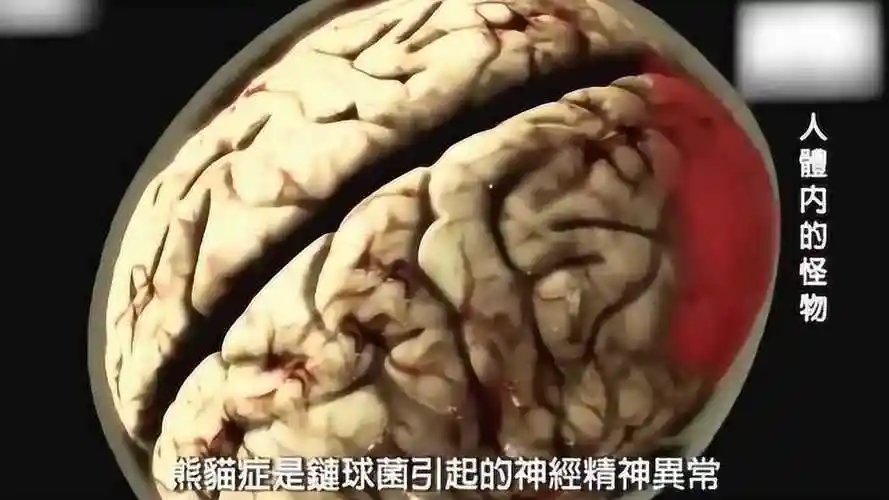 寄生在人体内的怪物,当寄生虫侵入你的脑细胞,细思极恐!