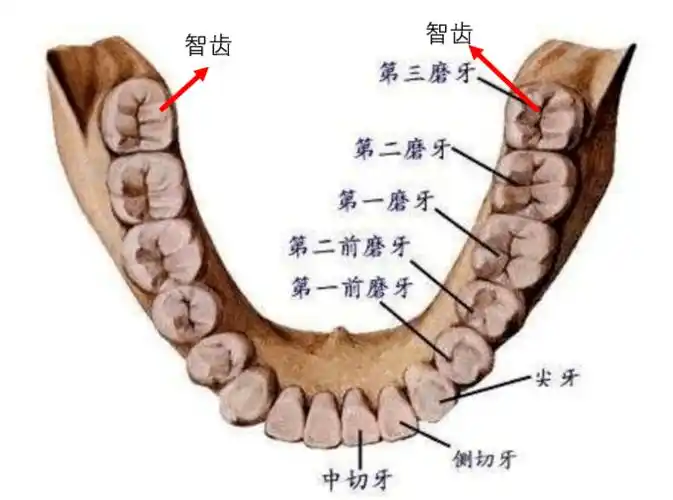 为什么医生不让我一次性把智齿都拔了?_牙齿