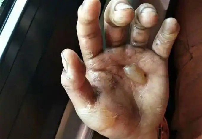 今天,让我们致敬这一双双辛勤的手!