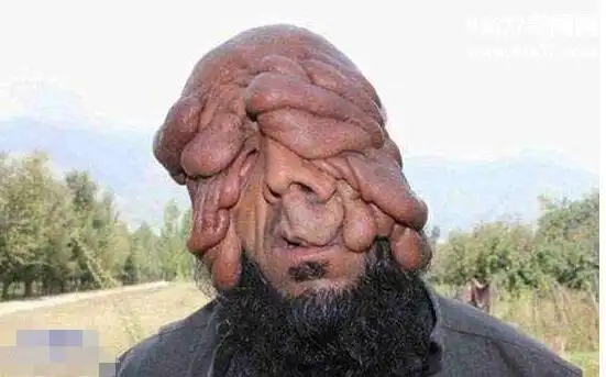 世界最丑男人图片,丑到出名靠脸吃饭(无法直视)