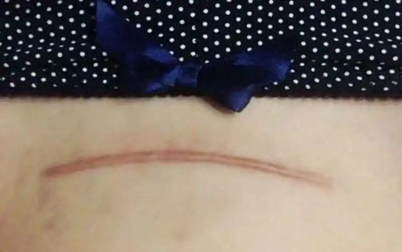 你是剖宫的还是顺产的?返回搜狐,查看更多