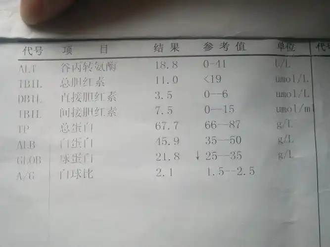 乙肝, 小三阳 ,检查结果,请大家帮我分析下?