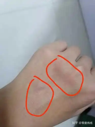 谈谈被老师打屁股或打手心的经历?