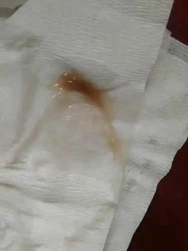 白带,如果不是在月经周期的附近,可能是宫寒,内分泌失调,子宫内膜异常