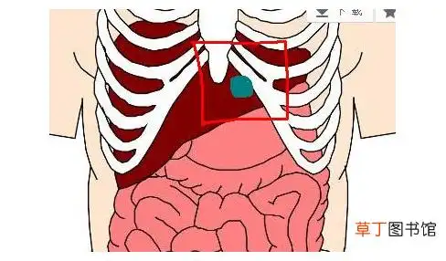 左侧肋骨隐痛是怎么回事-左侧肋骨隐痛怎么引起的