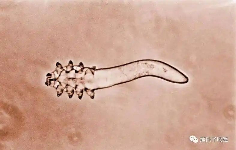 寄生螨(蠕形螨)72螨虫呢有很多种,在生活中我们常见的螨虫主要有