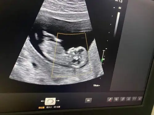 nt秒过看到你的小手手了