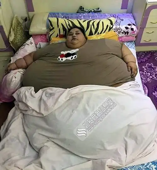 埃及女子重1200斤 过度肥胖导致生命危险