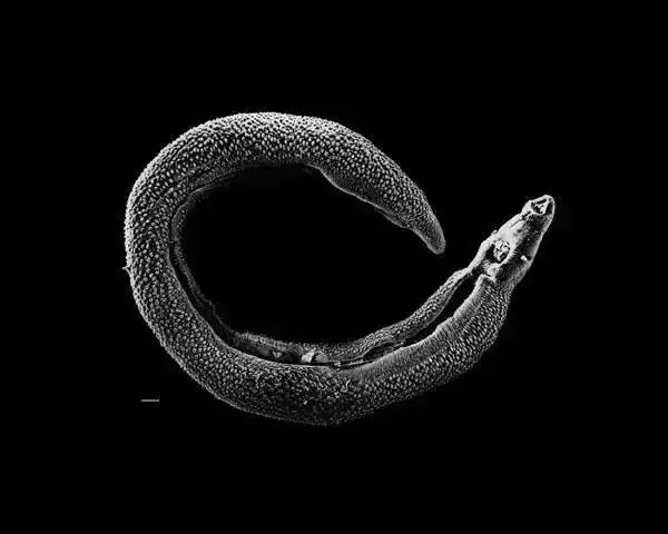 26种恶心的寄生虫,心脏不好千万别点开!慎入.