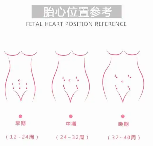 (b) 6~8个月时,随着胎儿的长大,胎心的位置也会上移.