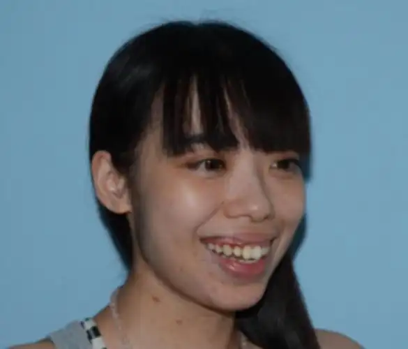 且看龅牙妹颜值逆袭之路