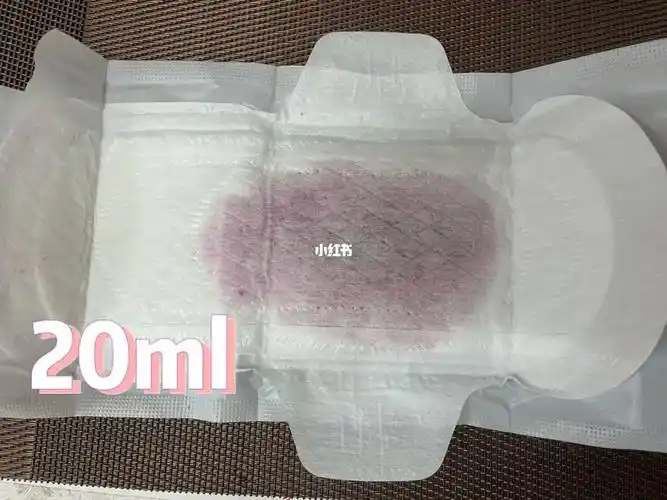 月经量过多的原因有哪些?别不当回事_大全-幸福起航