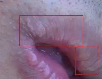 上嘴唇有白色小点,很多.谢谢!