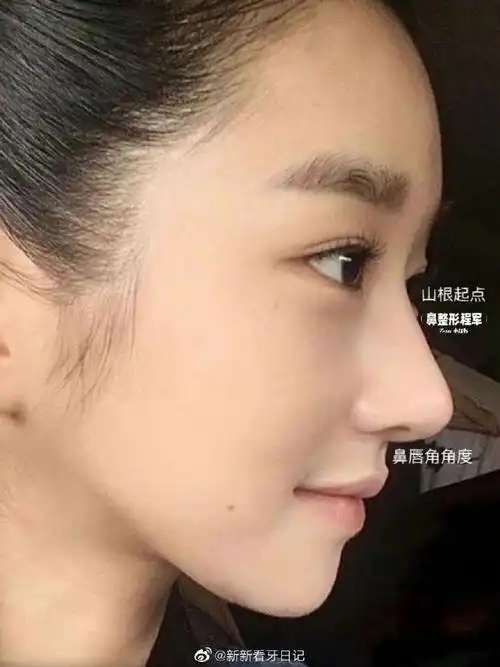 【新新的看脸分析】徐睿知的鼻子简直就是鼻模板 谁懂徐睿知的鼻子是