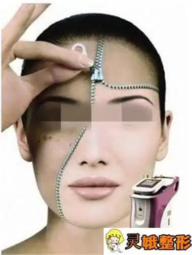 液氮提取雀斑法色沉31天能消除不