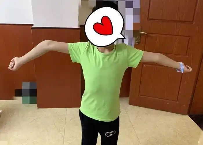 还孩子身体健康关爱肘内翻患儿儿童骨科