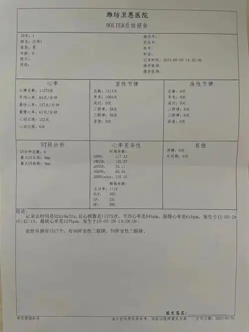 什么情况下需要做动态心电图?