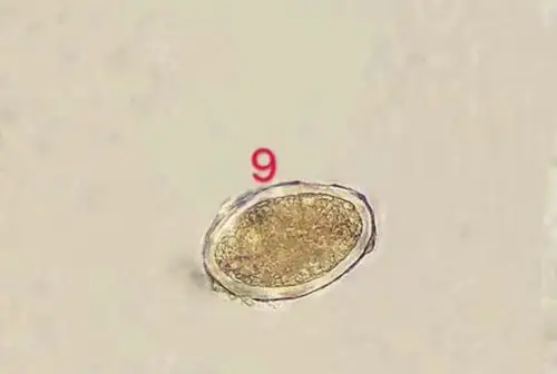 12.04寄生虫卵