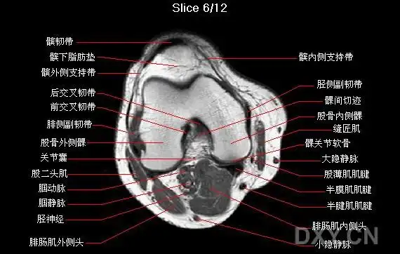 核磁共振mri的正常影像(头颈脊柱骨盆膝关)