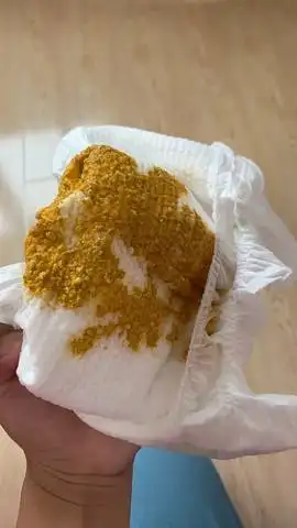 俩个月宝宝大便,主要母乳,奶粉一天喂的不多这大便正常吗